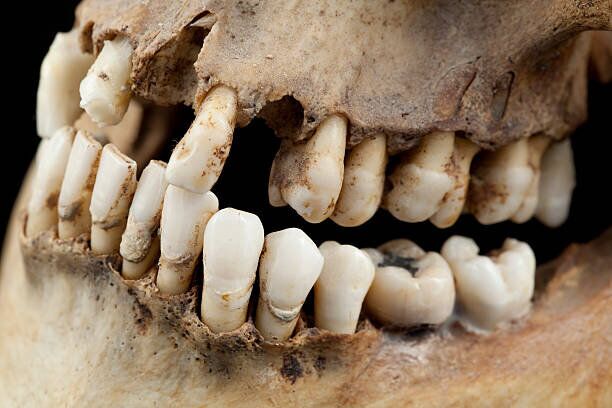 دندان وایکینگ‌ها 